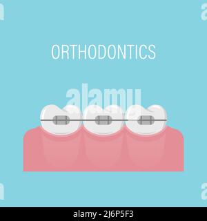 Alignment of teeth with braces. Poster with teeth in braces. Simple white healthy teeth in a row. Orthodontic treatment. Isolated vector illustration. Stock Vector