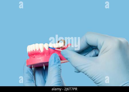 Human jaw layout and interdental toothpick brushes Stock Photo - Alamy