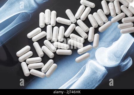 X-ray image and white capsules with dietary supplement or drug Stock Photo