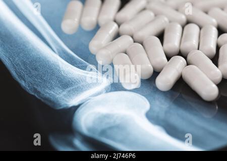 X-ray image and white capsules with dietary supplement or drug Stock Photo