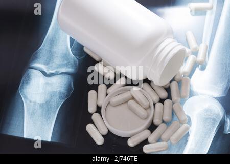 X-ray image and white capsules with dietary supplement or drug Stock Photo