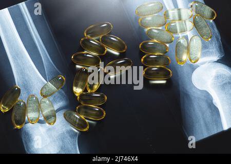 Close-up of X-ray image and capsules of fish or krill oil