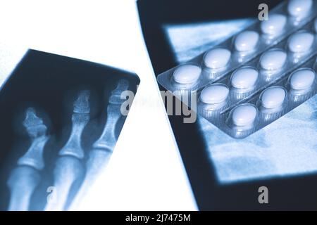 X-ray image and blister pack of white tablets Stock Photo