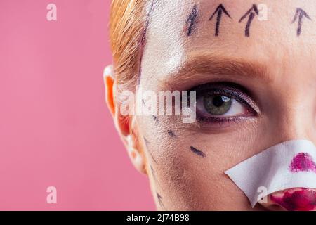 Patient in bandages. Nurses and young woman in studio pink background Stock Photo