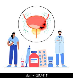 Bladder cancer stages, illustration Stock Photo