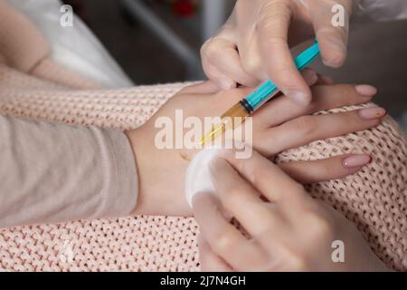 Doctor doing stem cell therapy on a patient's elbow after the injury. Treating knee pain with platelet-rich plasma injection. Treatment of arthritis a Stock Photo