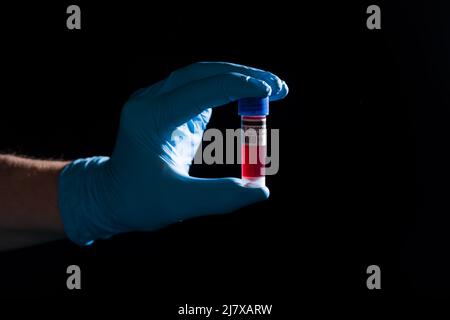 Close-up of doctor's hand wearing medical gloves holding a blood probe Stock Photo