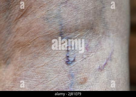 Prominent veins visible through the thin skin of Asian old woman. Stock Photo