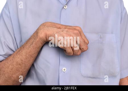 Hand muscle rigidity and finger flexion of Asian elder man Stock Photo ...