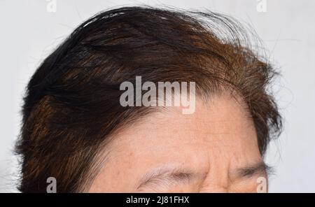 Skin creases or wrinkles at forehead of Southeast Asian, Myanmar or Burmese elder woman. Symptom of aging. Stock Photo