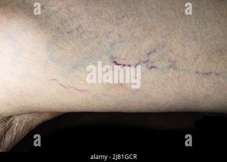 Prominent veins visible through the thin skin of Asian old woman. Stock Photo