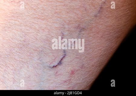 Prominent veins visible through the thin skin of Asian old woman. Stock Photo