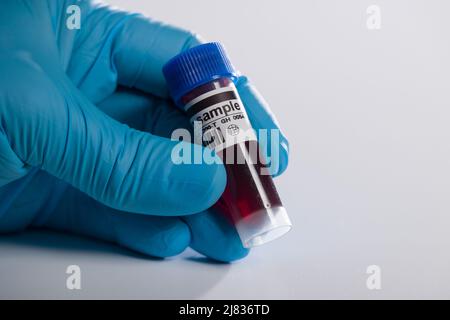 close-up of a hand in medical gloves handling a blood probe with coded information Stock Photo