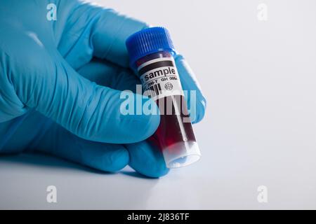 close-up of a hand in medical gloves handling a blood probe with coded information Stock Photo
