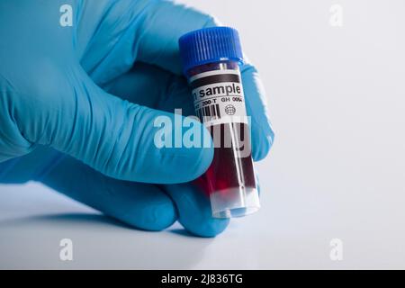 close-up of a hand in medical gloves handling a blood probe with coded information Stock Photo