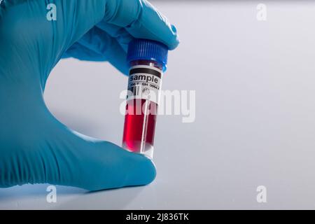 close-up of a hand in medical gloves handling a blood probe with coded information Stock Photo