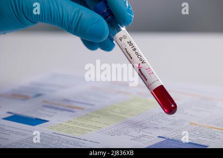 Close-up of hands in medical gloves holding a test tube after virus analysis with negative result markers Stock Photo