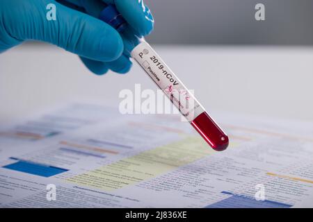 Close-up of hands in medical gloves holding a test tube after virus analysis with negative result markers Stock Photo
