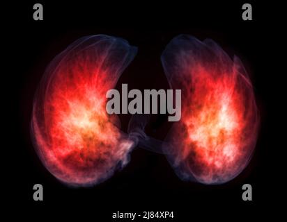 Base of Lung 3D rendering image for diagnosis TB,tuberculosis and covid-19 from CT-Scanner 3D. Stock Photo