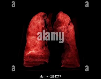 Lung 3D rendering image for diagnosis TB,tuberculosis and covid-19 from CT-Scanner 3D. Stock Photo