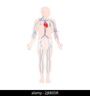 Femoral central venous catheter, illustration Stock Photo - Alamy