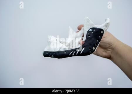 Person holding in hand facial mandibular endoprosthese printed metal 3D printer Stock Photo