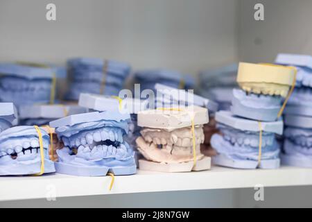 Dental gypsum models cast of a human dental jaw. Gypsum models lie on a shelf in a row. Laboratory prosthetics. Close-up shot. Shelf with lying on her Stock Photo