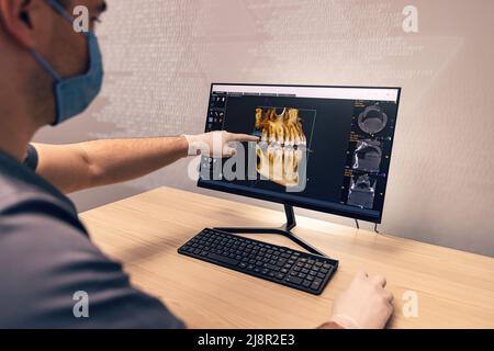 Doctor looking at human teeth x-ray on computer monitor. Modern dental clinic. Stock Photo