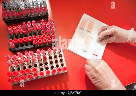 Aug 19, 2011. Blood samples in a lab collected to test. (CTK Photo/Grzegorz Klatka) Stock Photo