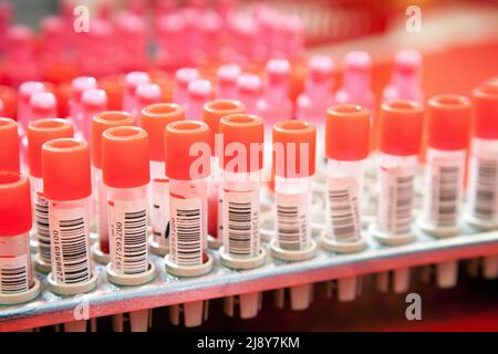 Aug 19, 2011. Blood samples in a lab collected to test. (CTK Photo/Grzegorz Klatka) Stock Photo