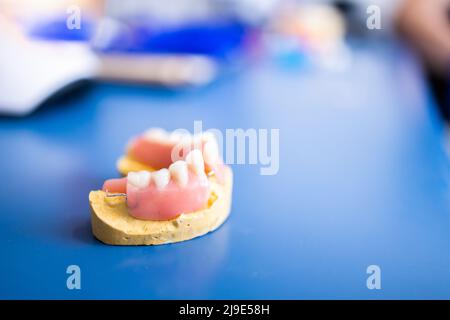 Isolated artificial jaw. Dental Prosthesis. Zirconium porcelain tooth plate. Prosthetics work Stock Photo