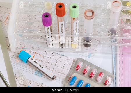 Tube with positive Monkeypox test blood on analysis form close up with ...
