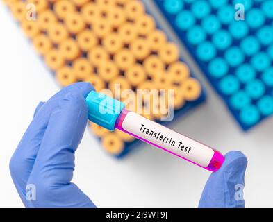 Biochemistry Blood sample for Transferrin test Stock Photo - Alamy