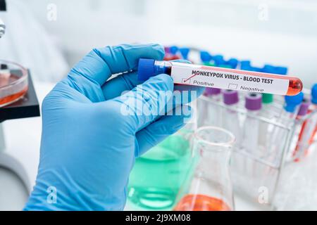Tube with positive Monkeypox test blood on analysis form close up with ...
