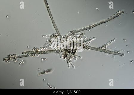 Mold filaments and spores from the Aspergillus mold under the ...