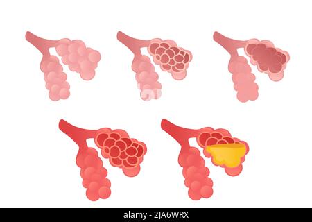 Set of Human Alveoli cartoon design human anatomy organ vector illustration on white background Stock Vector