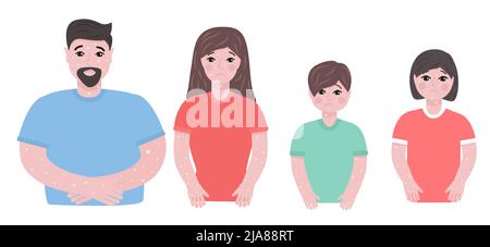 Sad people with . Symptoms of monkeypox. Ulcers on skin. Stock Vector