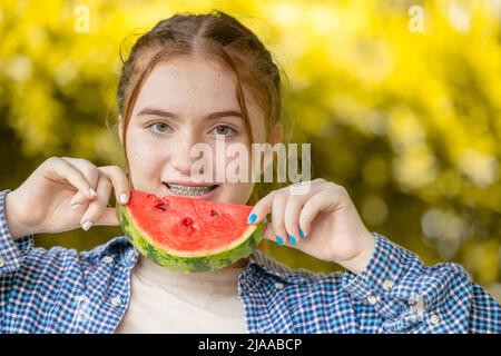 beautiful teen girl smiling with watermelon and dental care orthodontic treatment teeth aligning with braces or aligners Stock Photo