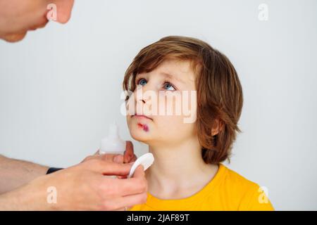 Dad doctor father treats bruised wound on his son school boy kid face. Man cleans addresses the sore wound on child face on white background with copy Stock Photo