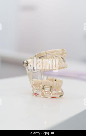 Medical object in studio, modeled glass denture, dental article for didactic means, details of teeth, molars, gums and bite Stock Photo