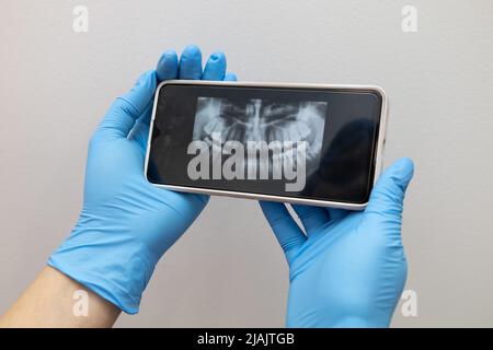 x-ray examination results on mobile device of a person's mouth, examining for dental treatment, technology Stock Photo