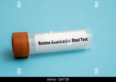 Routine Examination Stool Test Stock Photo - Alamy