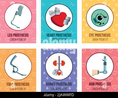 Orthopedic medical prothesis flat cards collection with artificial kidney eye implants and prosthetic limbs isolated vector illustration Stock Vector