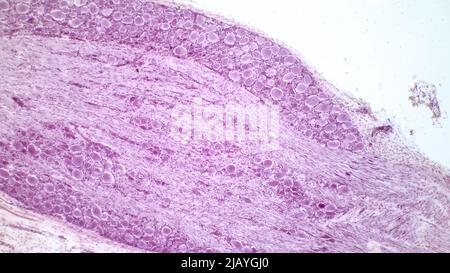 Dorsal root ganglion. Pseudounipolar neurons of a dorsal root ganglion. Hematoxlyn and eosin stain. Magnification: x40. Stock Photo