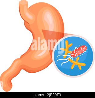 Isometric gastroenterology composition with image of stomach with helicobacteria vector illustration Stock Vector
