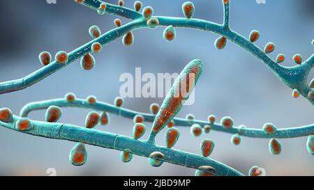 Fungal infection on a man's hand, illustration. Known as ringworm  infection, or tinea manuum. It can be caused by various fungi, including  Trichophyton rubrum. It causes severe itching. The disease is highly