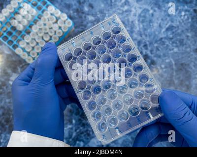 Laboratory items are on the work table in the laboratory, test tubes, pencil cases, tablets, lycrobiological loop. Stock Photo