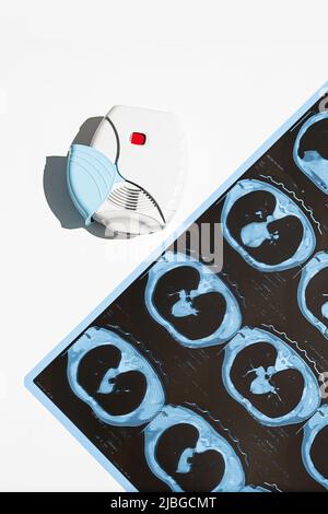 Asthma inhaler and CT scan of the lungs on white table. Aerosol for inhalation for treat lung inflammation and prevent asthma attack. Stock Photo