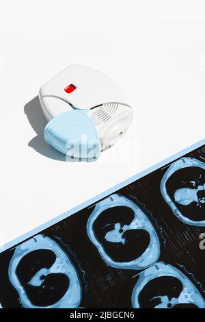 Asthma inhaler and CT scan of the lungs on white table. Aerosol for ...