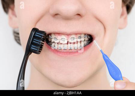 Young man with dental braces holding brushes for cleaning his teeth. Stock Photo